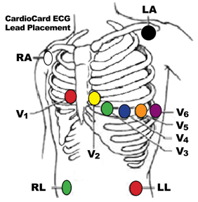 ekg lead placement chart - Keski